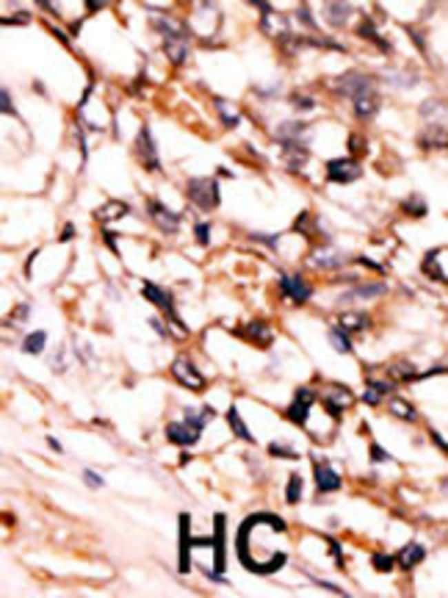 Anti-Phospho-MAPKAPK5-S93 0.1 mg MG