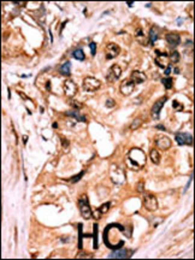 Anti-Phospho-MEK1-S217/221 0.1 mg MG