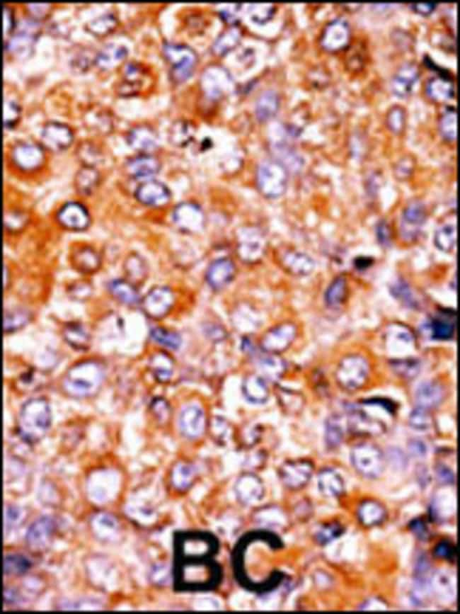 ANTI-PHOSPHO-MYT1-T495, 0,1 MG