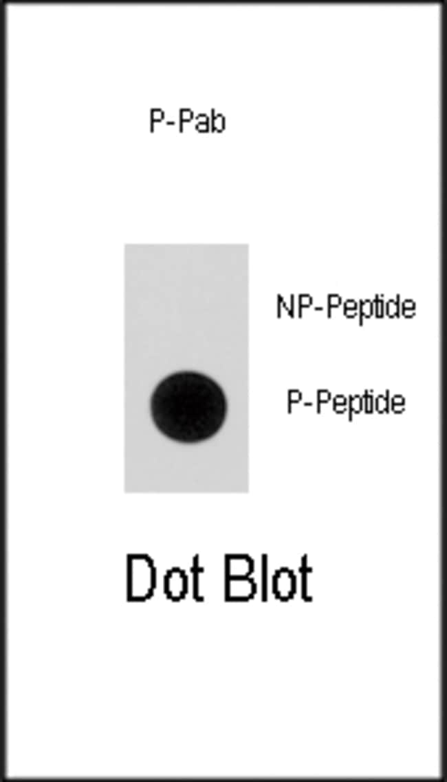 Anti-Phospho-p21Cip1-pS130 0.1 mg MG
