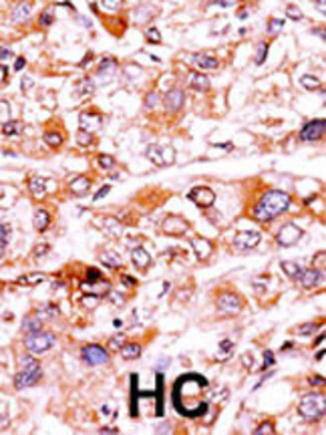 Anti-Phospho-P21CIP1-T57 0.1 mg MG