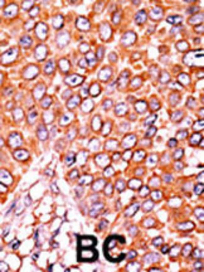 Anti-Phospho-p27Kip1-T157 0.1 mg MG