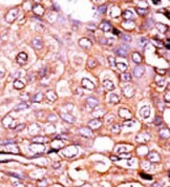 100 UG Polyclonal antibody,host rabbit,