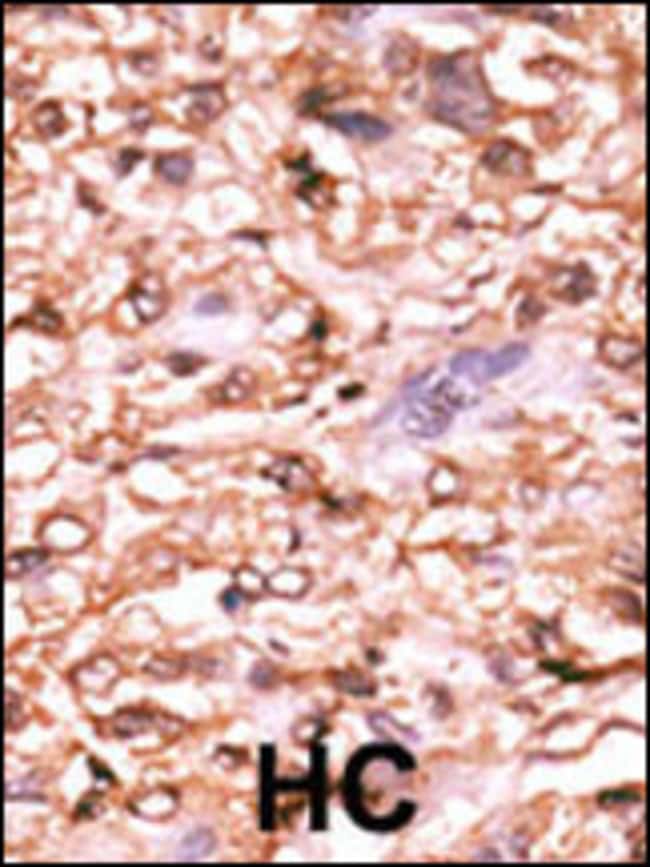 ANTI-PHOSPHO-P53-T18, 0,1 MG