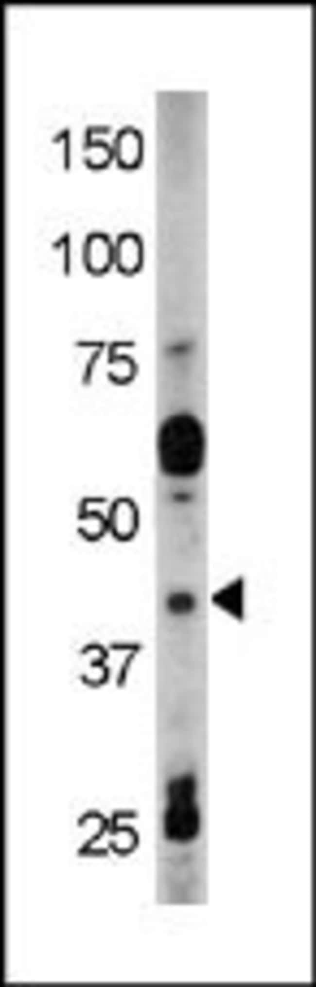 ANTI-PHOSPHO-RAD9-Y28, 0,1mg .