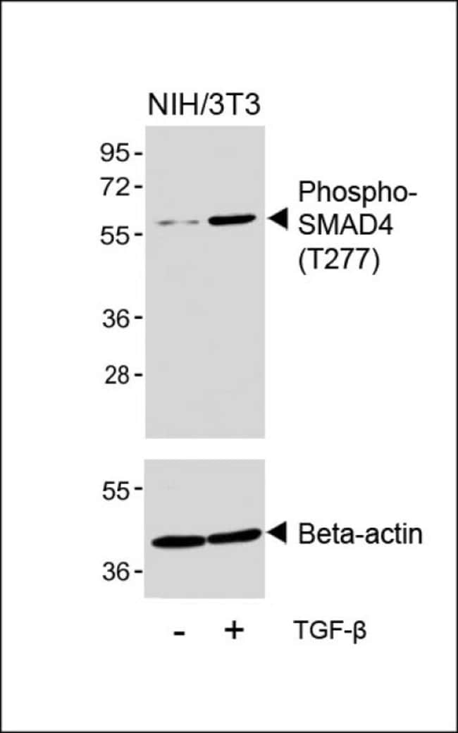 Anti-Phospho-SMAD4-T277 0.1 mg MG