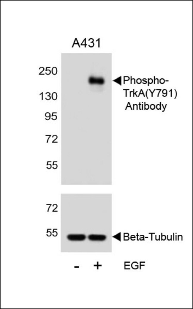 100UG ANTI-PHOSPHO-TRKA-Y791 .
