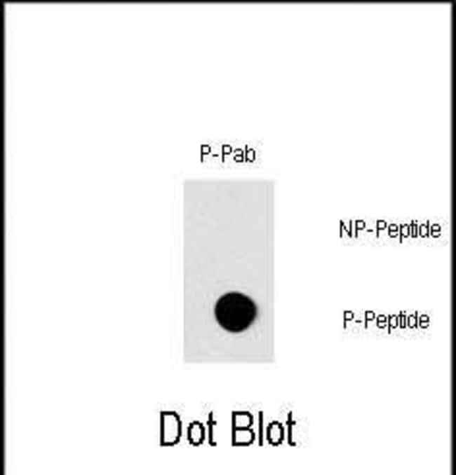 ANTI-PHOSPHO-RAF1-S296, 0,1 MG