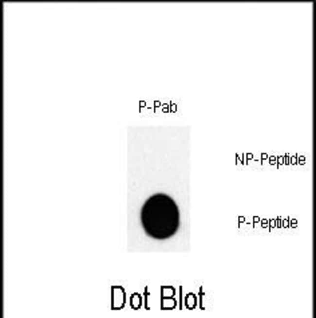 ANTI-PHOSPHO-JUN-T243, 0,1 MG