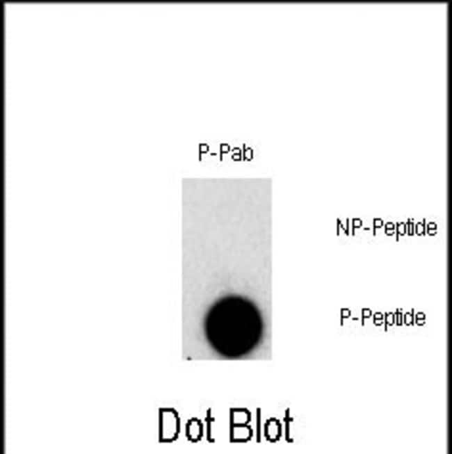 Anti-Phospho-FGFR1-Y307 0.1 mg MG