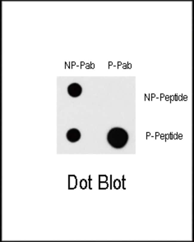 Anti-Phospho-MAP3K1-T1383 0.1 mg MG