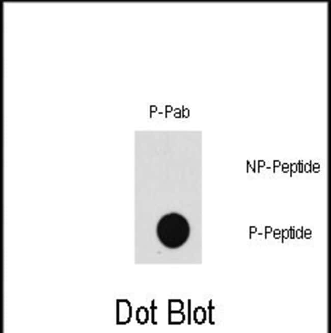 Anti-Phospho-MAP3K7-T187 0.1 mg MG