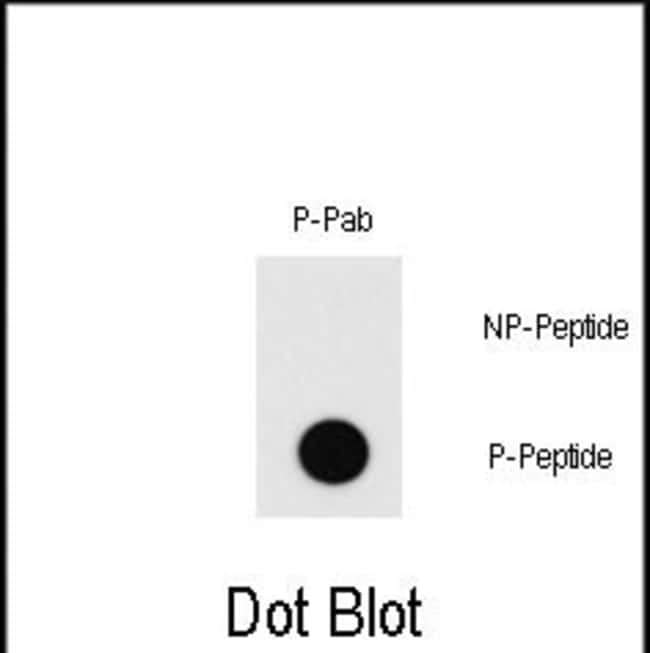 100UG ANTI-PHOSPHO-MEF2C-T20 .