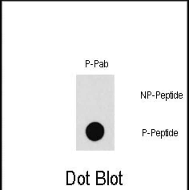 ANTI-PHOSPHO-PAK1-T212, 0,1 MG