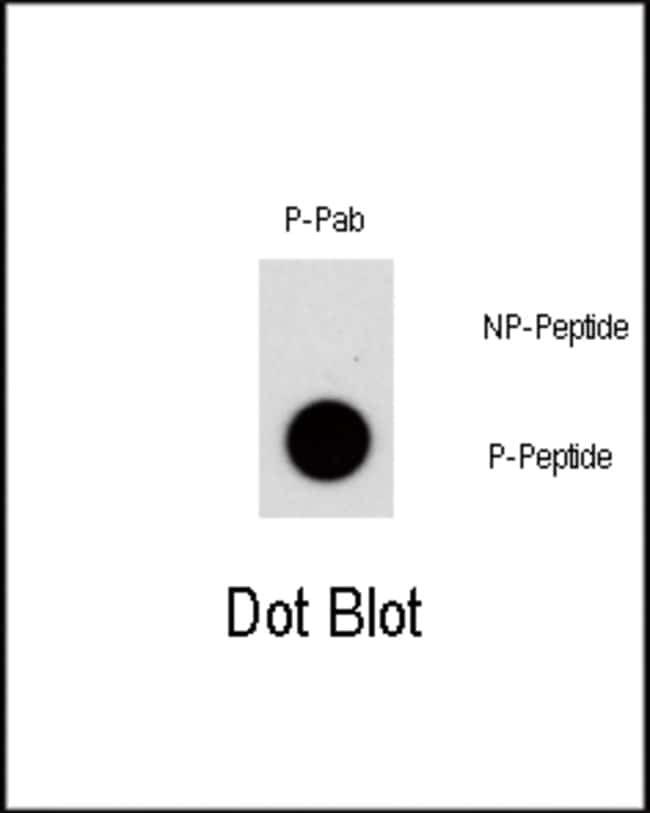 Anti-Phospho-NR4A1-S351 0.1 mg MG