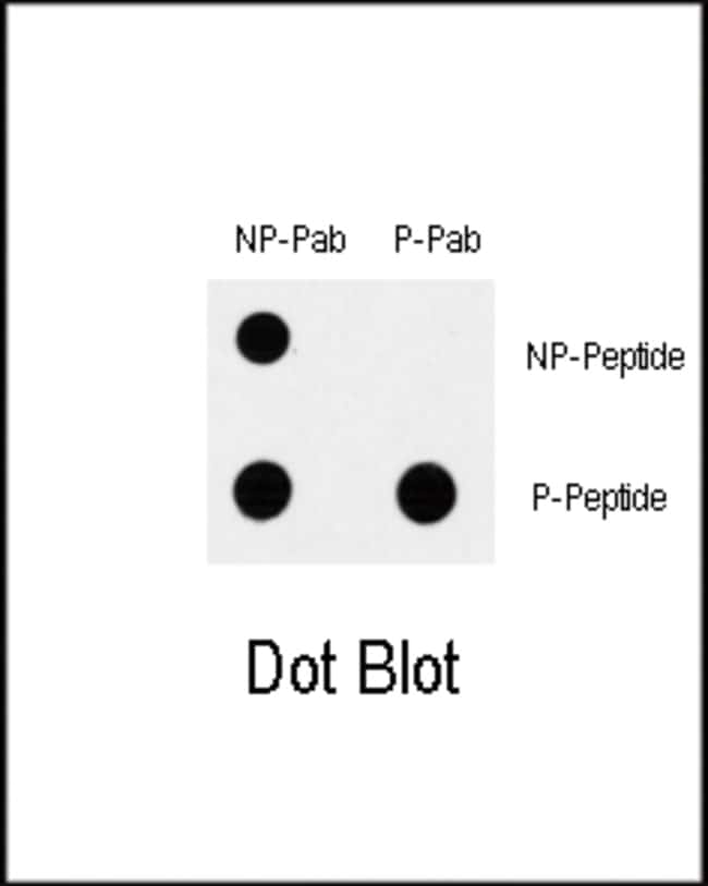 Anti-Phospho-MAP3K7-S192 0.1 mg MG