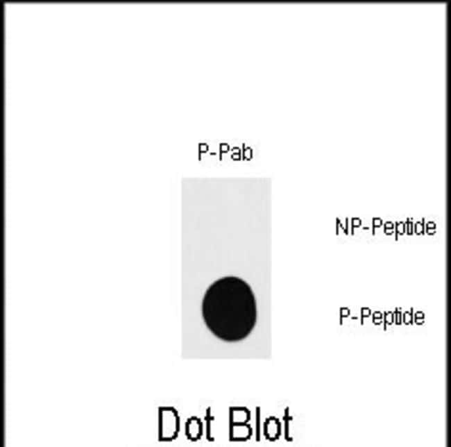 Anti-Phospho-RPS6KB1-pS418 0.1 mg MG