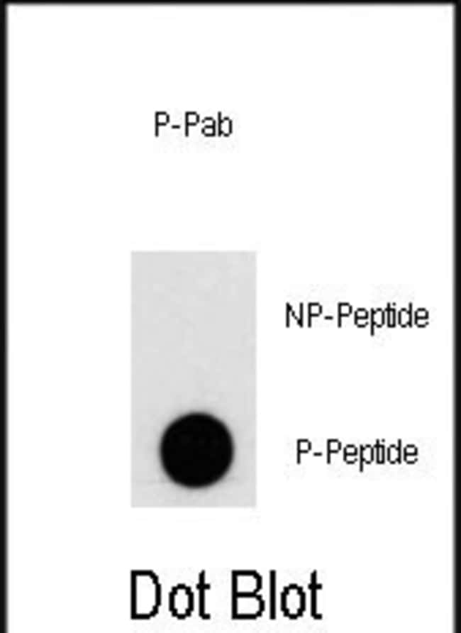 Anti-Phospho-PI3KC3-S676 0.1 mg MG