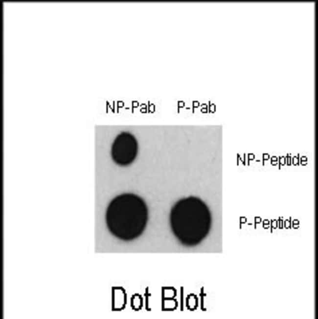 ANTI-PHOSPHO-ATF2-S322, 0,1 MG