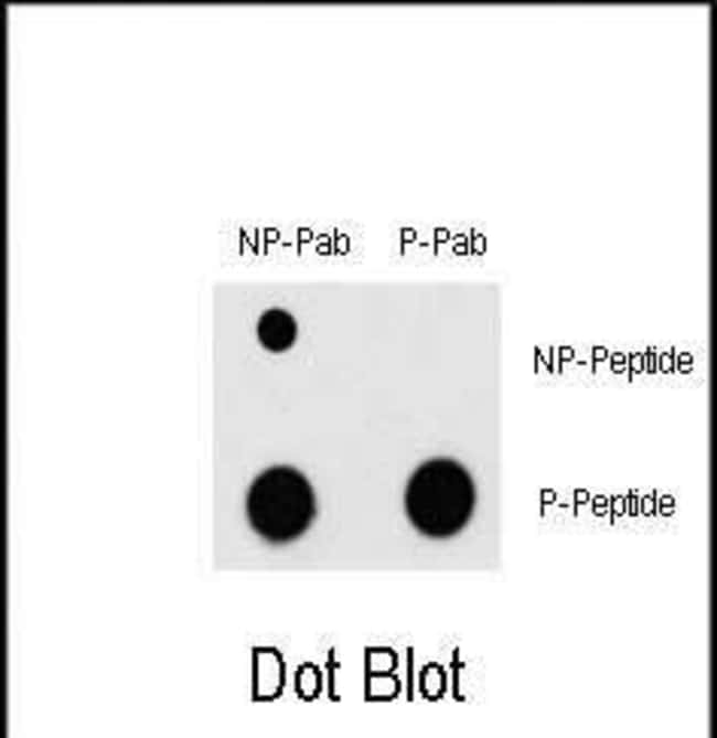 Anti-Phospho-MEF2C-T300 0.1 mg MG