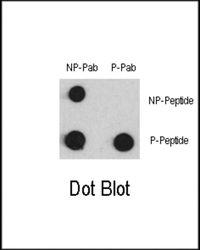 Anti-Phospho-MEF2C-pS387 0.1 mg MG