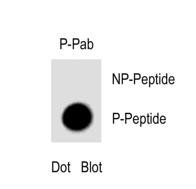 Anti-Phospho-PI3KC3-S164 0.1 mg MG