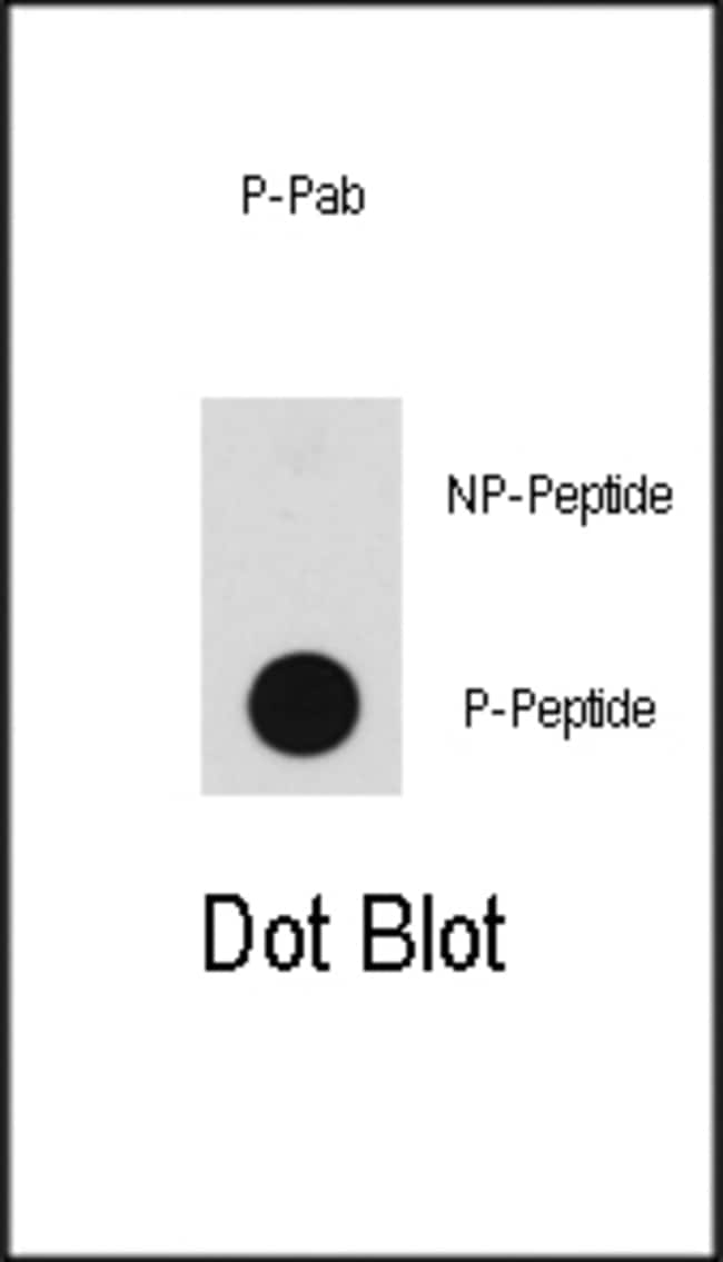 Anti-Phospho-BRAF-pT598 0.1 mg MG