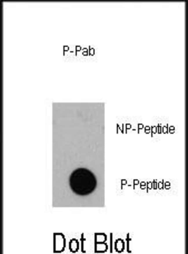 Anti-Phospho-EIF4EBP1-pT36 0.1 mg MG