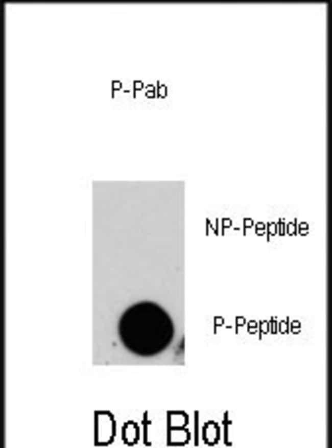 Anti-Phospho-MAP4K4-pS629 0.1 mg MG