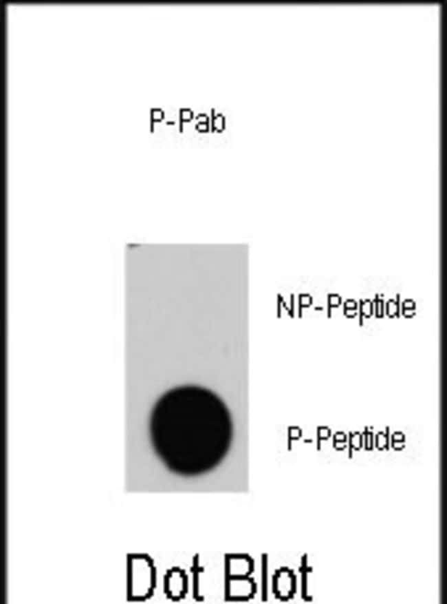 ANTI-PHOSPHO-RAF1-Y340, 0,1 MG