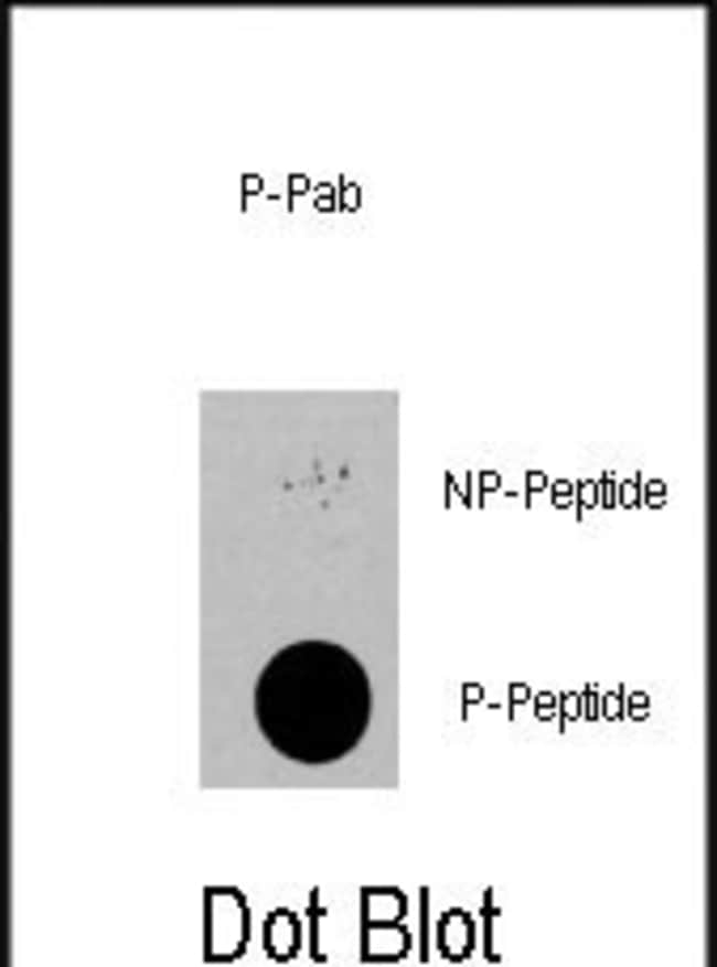 Anti-Phospho-PDPK1-S396 0.1 mg MG