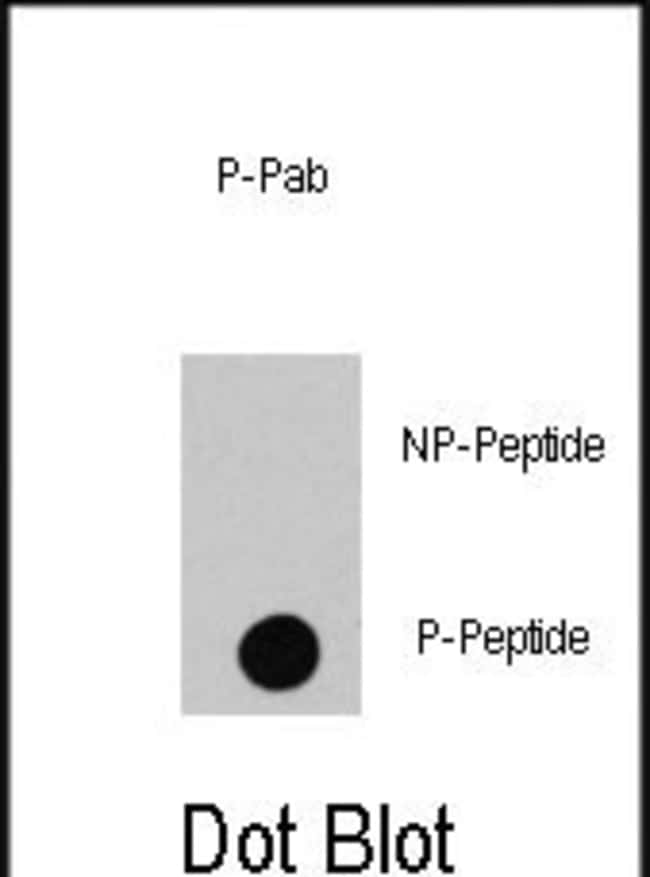 ANTI-PHOSPHO-RAF1-S494, 0,1mg .
