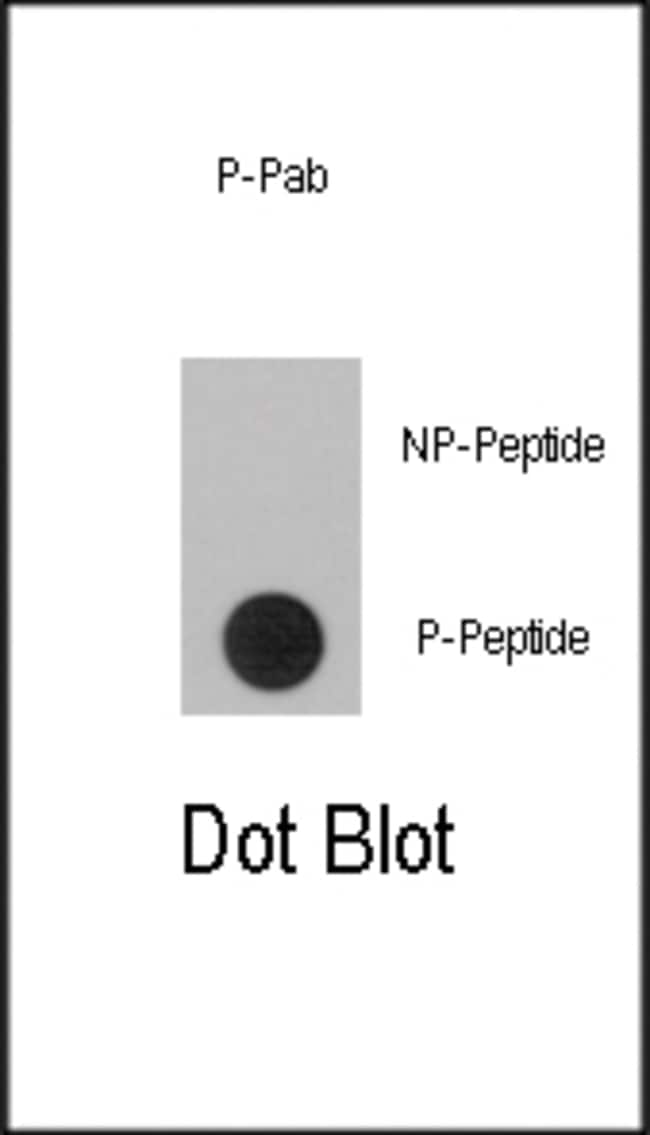Anti-Phospho-RPS6KA1-S363 0.1 mg MG