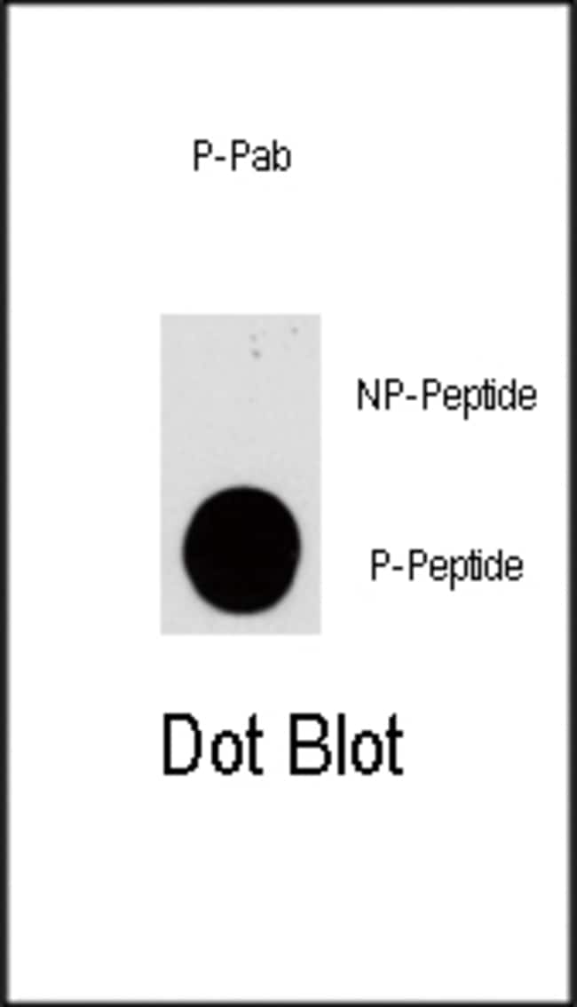 Anti-Phospho-PIK3CG-S1100 0.1 mg MG