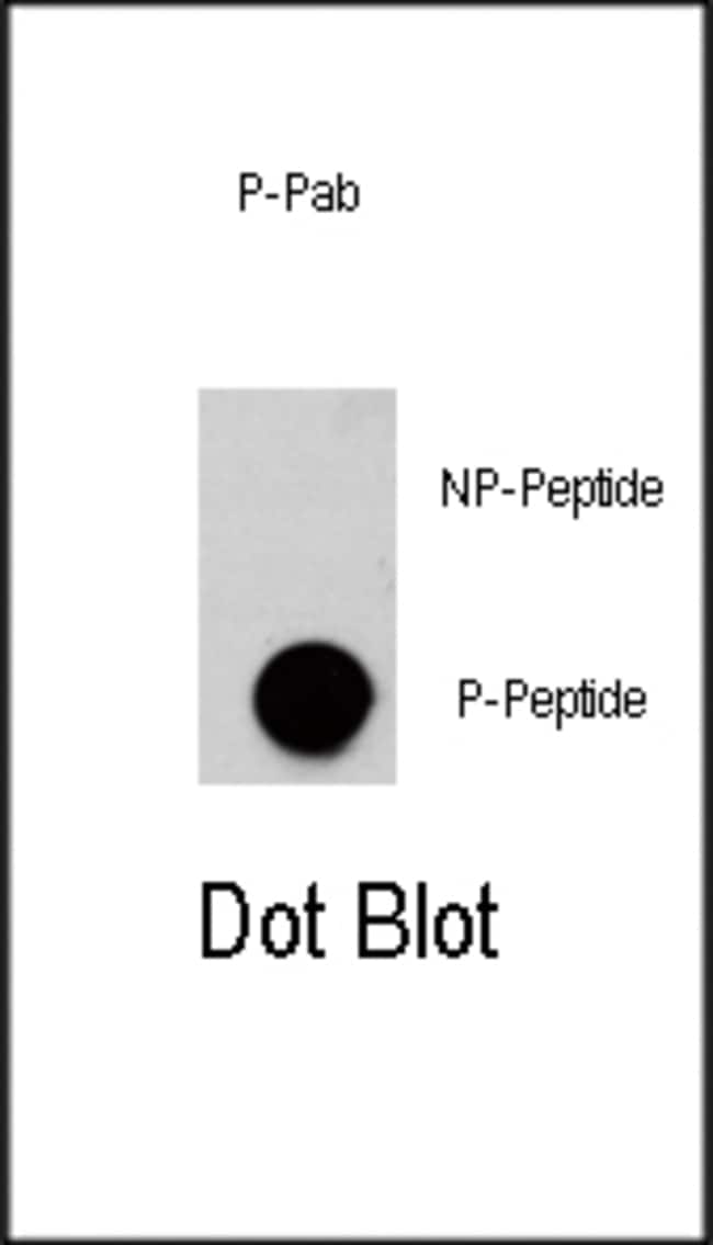 100UG ANTI-PHOSPHO-AKT3-S472 .