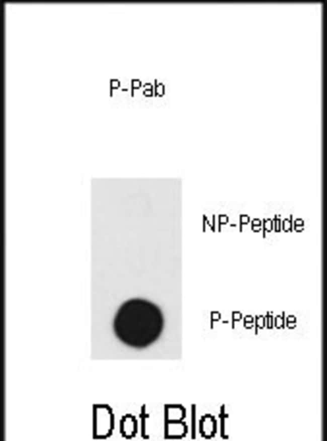 Anti-Phospho-DNA-PK-T2609 0.1 mg MG