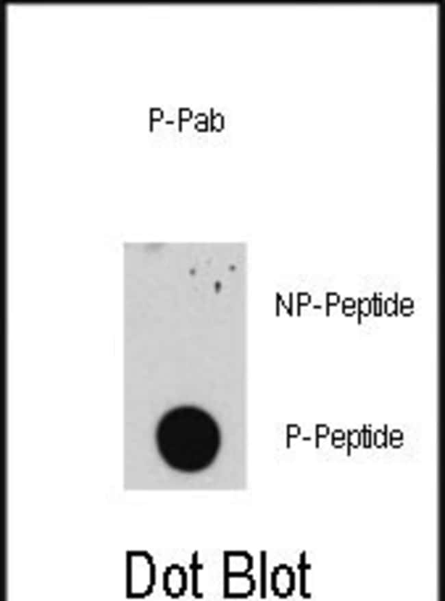 ANTI-PHOSPHO-E2F1-S332, 0,1 MG