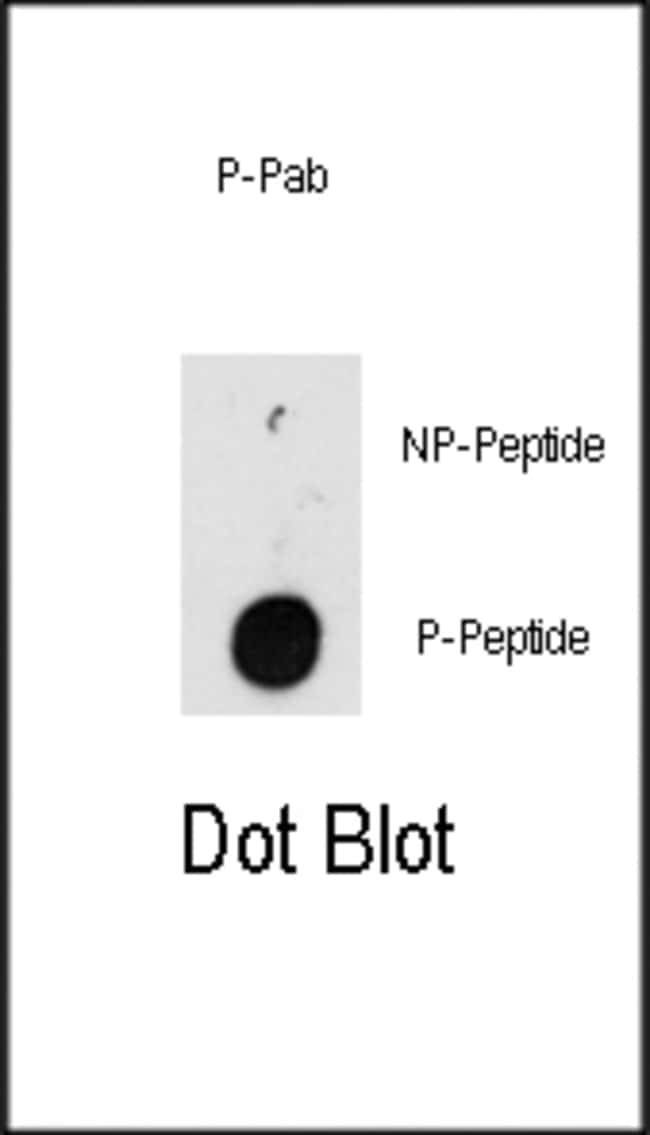 ANTI-PHOSPHO-ILK-T173, 0,1mg .