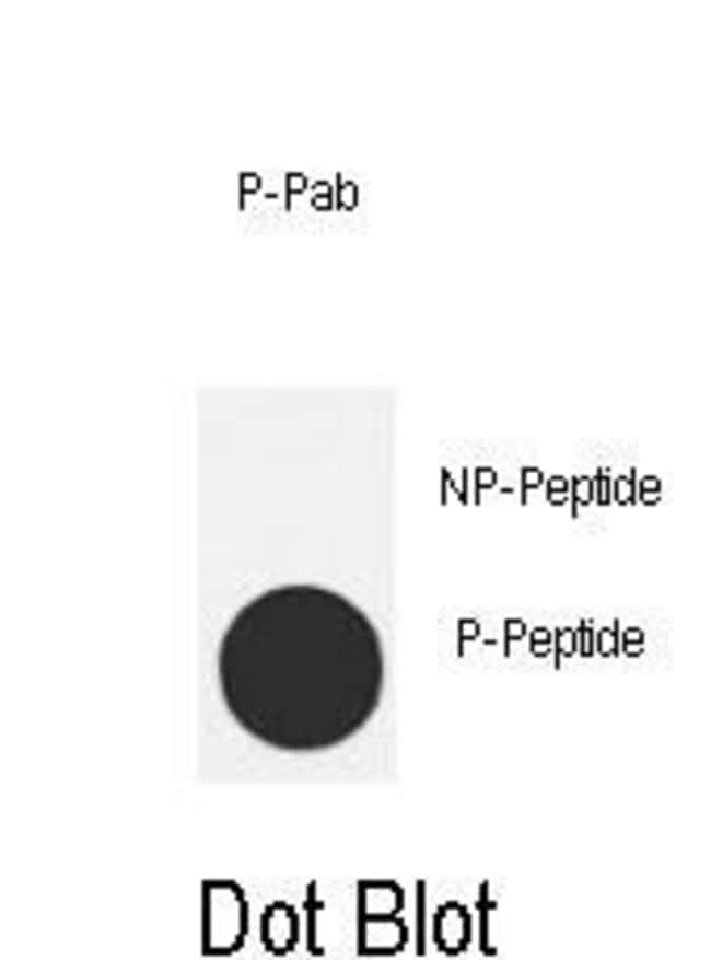 100 µG ANTI-PHOSPHO-MDM2-T218 .