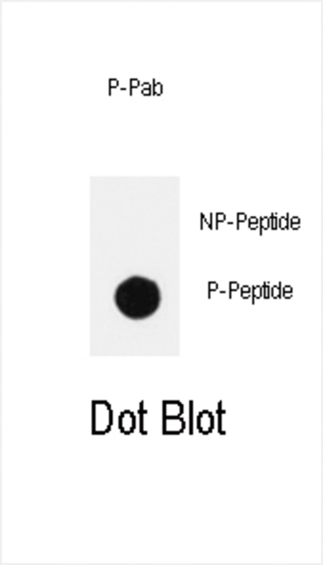 Anti-Phospho-PIK3CD-Y485 0.1 mg MG