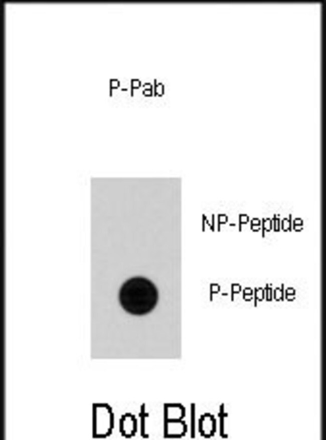 Anti-Phospho-Cdc25A-S79 0.1 mg MG