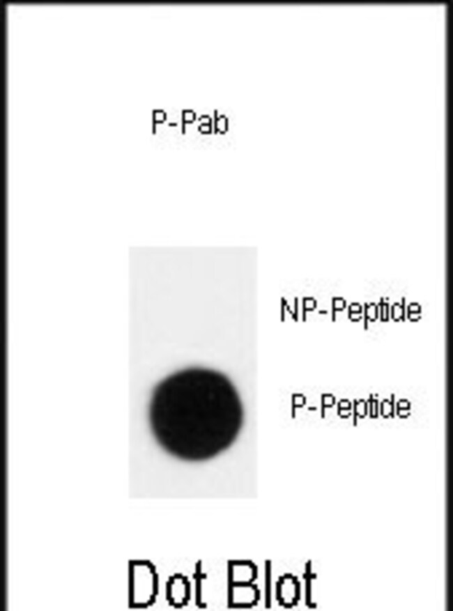 Anti-Phospho-p27Kip1-T198 0.1 mg MG
