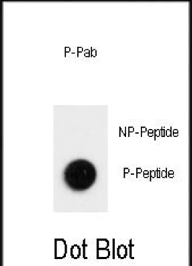 ANTI-PHOSPHO-LC3 - T12, 0,1 MG