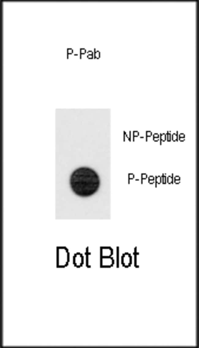 Anti-Phospho-TERT-pS1125 0.1 mg MG