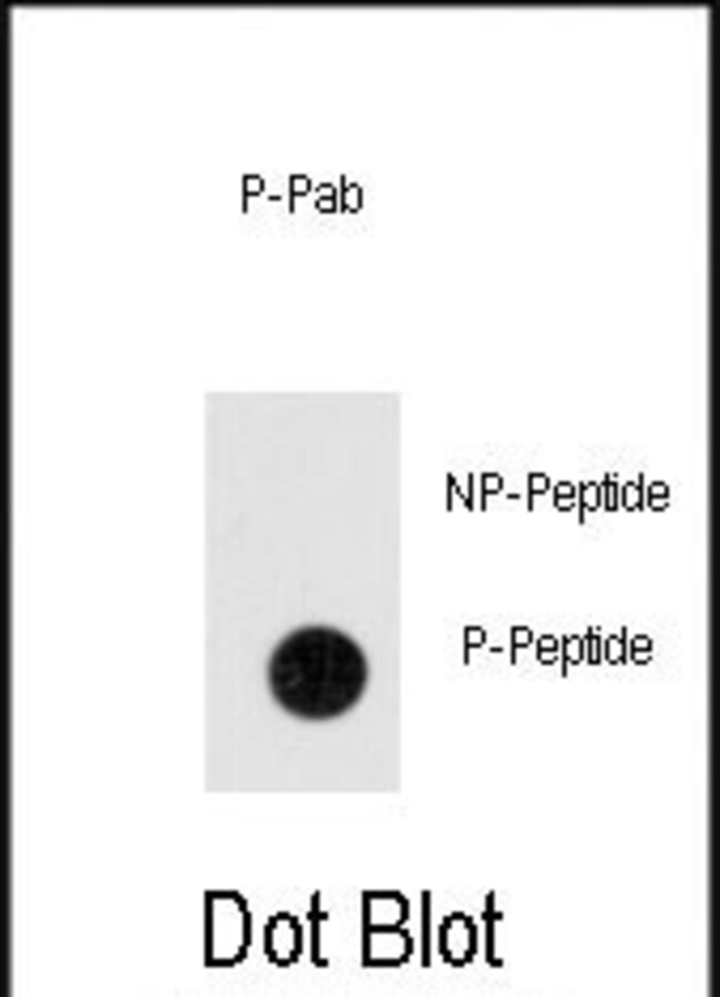 Anti-Phospho-ANTXR1-pY382 0.1 mg MG