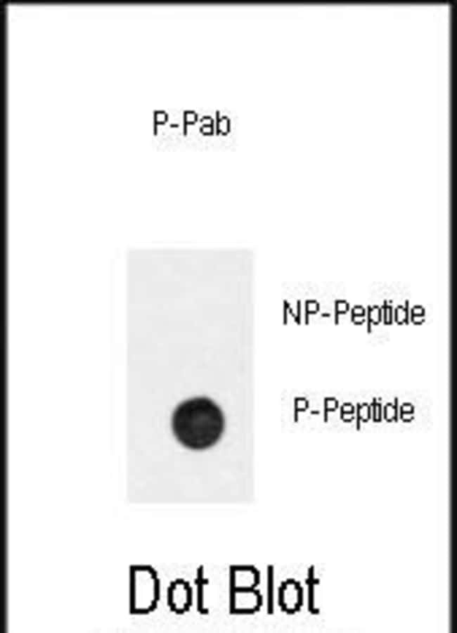 Anti-Phospho-BAR2-pS261 0.1 mg MG