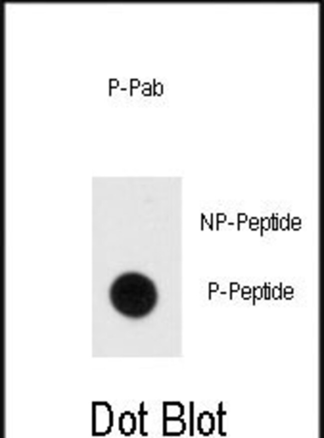 ANTI-PHOSPHO-MBP-PY203, 0,1mg .