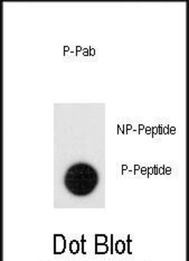 Anti-Phospho-Leo1-pS551 0.1 mg MG
