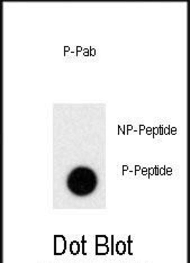 100UG ANTI-PHOSPHO-PRL-PS163 .