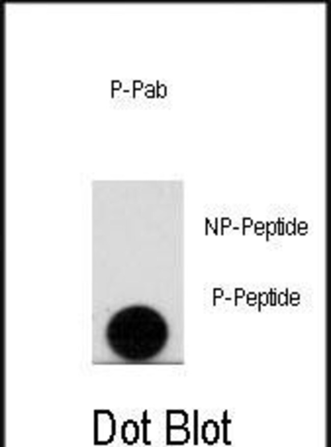 ANTI-PHOSPHO-LEO1-PS10, 0,1 MG